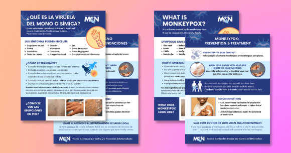 Nuevo recurso con un lenguaje sencillo y accesible para todos sobre la viruela del mono o símica disponible en inglés y español